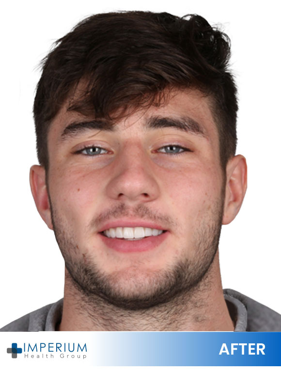 After 4